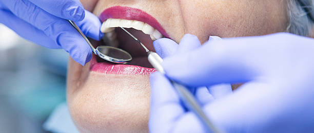 Best Emergency Broken Tooth Repair in Creston, OH